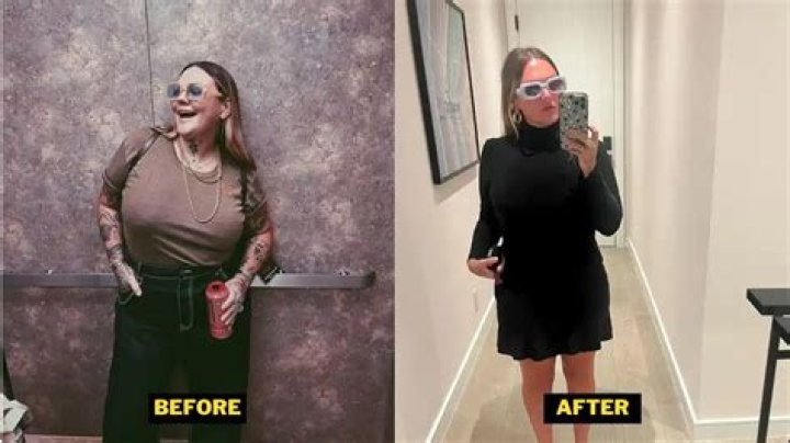 Did Elle King Get Plastic Surgery? Has Elle King Lost Weight?